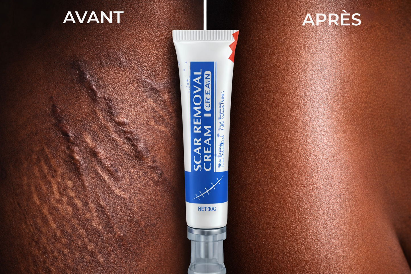 Crème Anti-Cicatrices et Vergeture