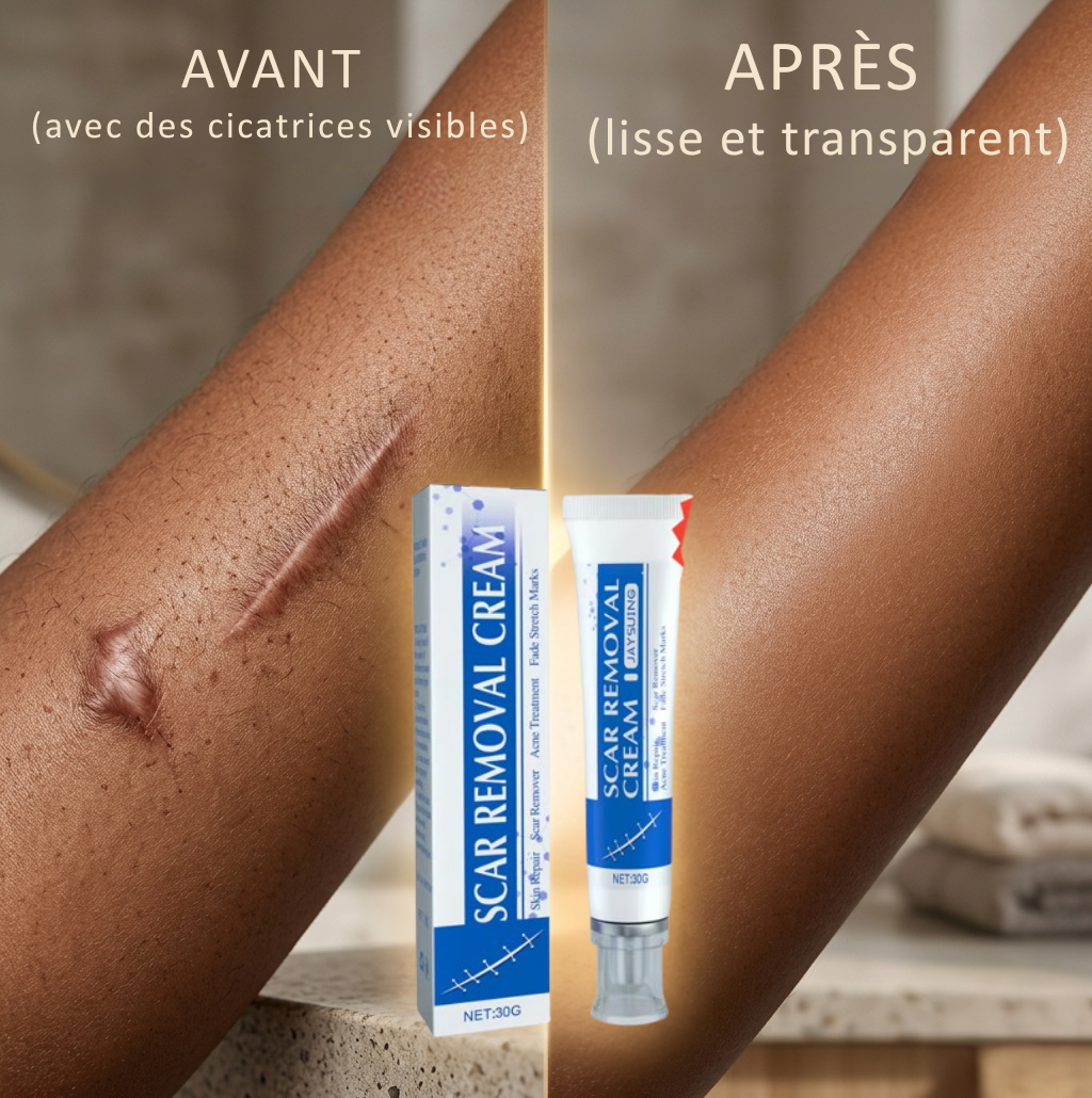 Crème Anti-Cicatrices et Vergeture