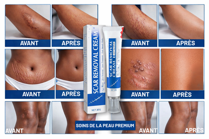 Crème Anti-Cicatrices et Vergeture