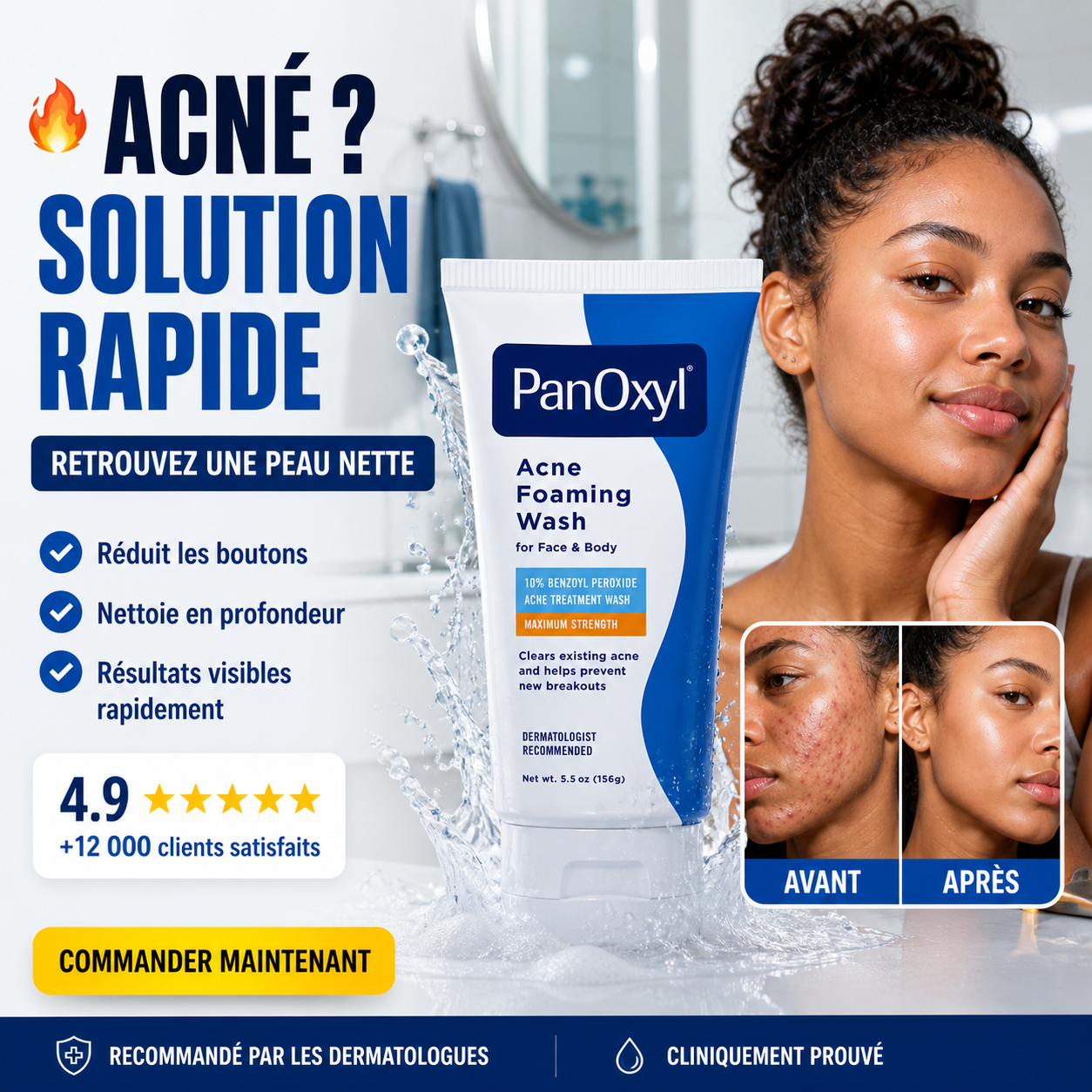 PanOxyl Acné Foaming Wash