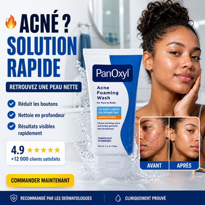 PanOxyl Acné Foaming Wash