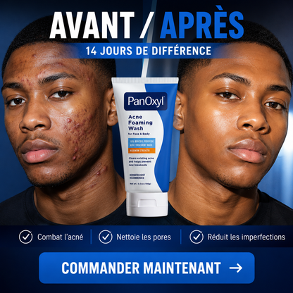 PanOxyl Acné Foaming Wash