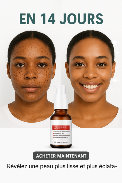 SÉRUM DE VISAGE ÉCLAIRCISSANTE À LA VITAMINE C