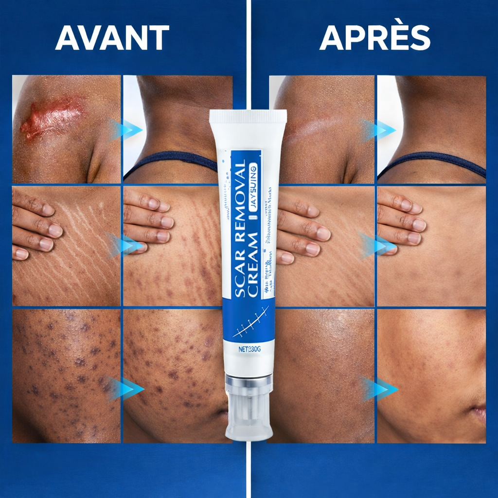 Crème Anti-Cicatrices et Vergeture