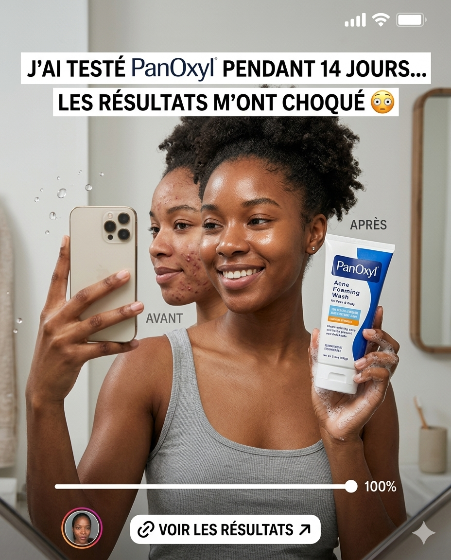 PanOxyl Acné Foaming Wash