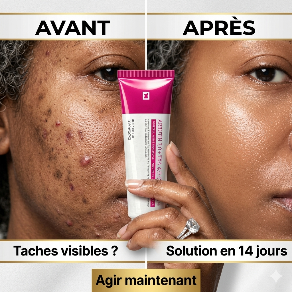 Crème coréenne avancée à l'arbutine et au TXA (Arbutin 7.0 + TXA 4.0)
