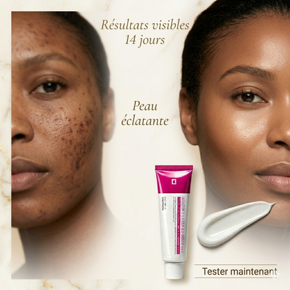 Crème coréenne avancée à l'arbutine et au TXA (Arbutin 7.0 + TXA 4.0)