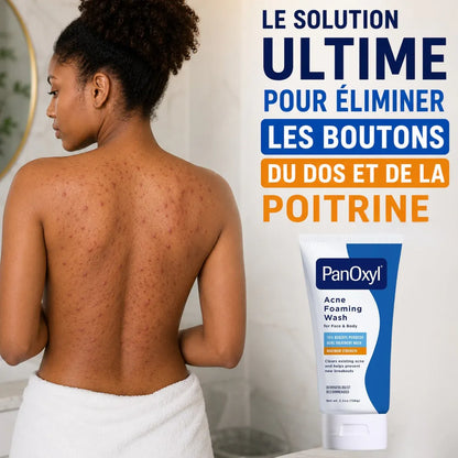 PanOxyl : Gel Moussant Anti-Acné