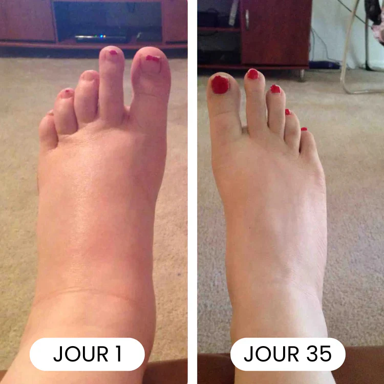 NUVÉA® | Drainage Lymphatique Naturel