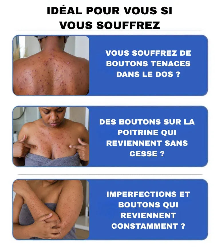 PanOxyl : Gel Moussant Anti-Acné