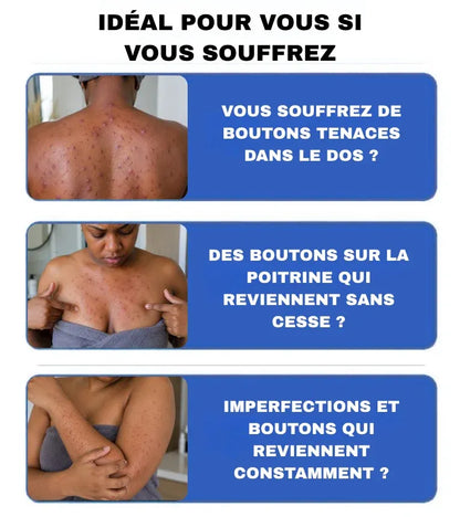 PanOxyl : Gel Moussant Anti-Acné