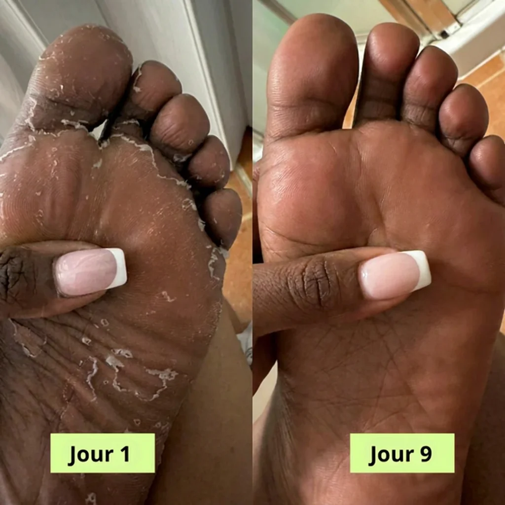 MARIKA® Savon Purifiant Antifongique